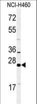 RAB27B Antibody (aa186-215)
