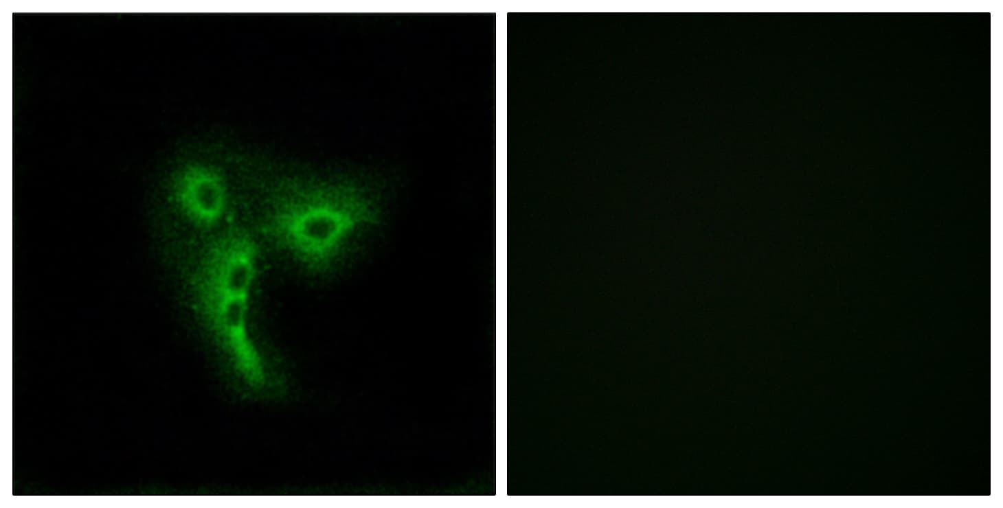 OR4A4 + OR4A47 Antibody (C-Terminus)