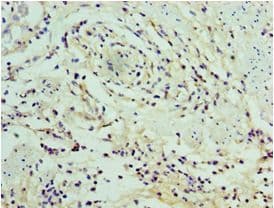 SERPINA12 / Vaspin Antibody (aa20-320)