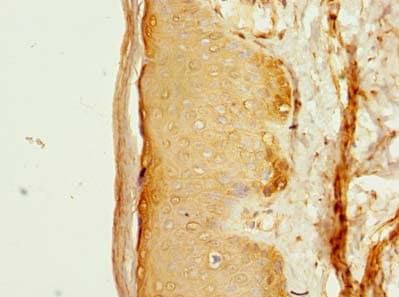 FAM118A Antibody