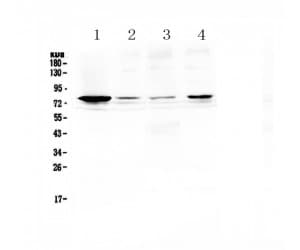 TNFRSF11A / RANK Antibody