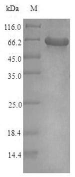 Human KCNJ10 / SESAME / KIR4.1 Protein (Recombinant 6His-SUMO, N-terminus)