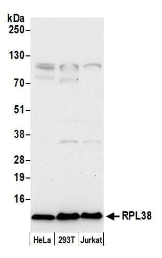 RPL38 / Ribosomal Protein L38 Antibody (aa20-70)