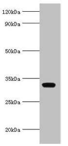 Polyclonal Rabbit anti-Human AGPAT1 Antibody (aa204-283, IHC, WB)