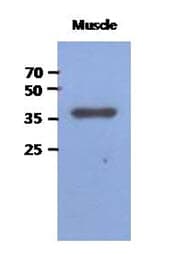 FBP2 Antibody (clone AT1E11)