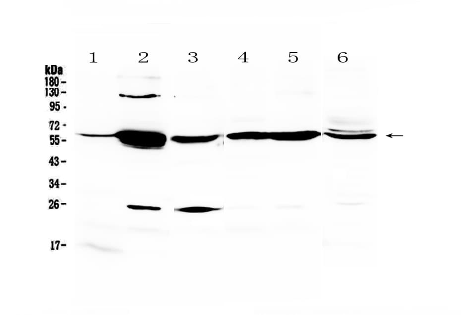 Polyclonal Rabbit anti-Human GK / Glycerol Kinase Antibody (IHC, WB)