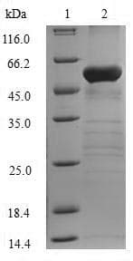 Human FBP1 Protein (Recombinant 10His-SUMO, N-terminus + Myc, C-terminus)