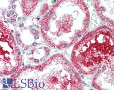 IHC-plus™ ACADL Antibody