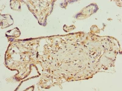 PLEKHA8 Antibody