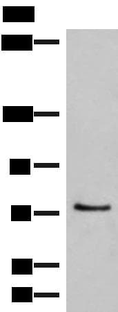 MCMBP / C10orf119 Antibody