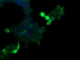 MDM4 / MDMX Antibody (clone OTI4B10)