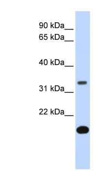 Polyclonal Rabbit anti-Human FST / Follistatin Antibody (aa144-193, WB)