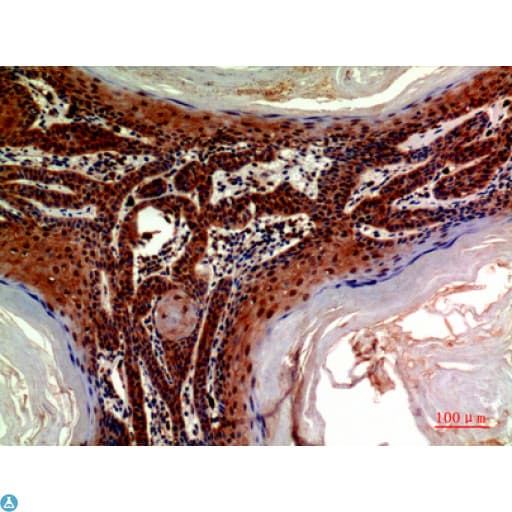 ADAMTS18 Antibody