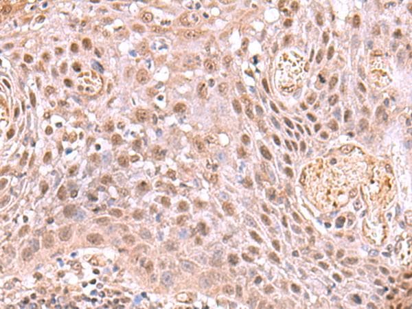 Polyclonal Rabbit anti-Human DDI2 Antibody (IHC, WB)