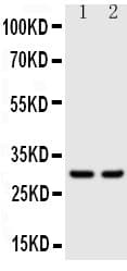 KLK1 / Kallikrein 1 Antibody (aa243-261)