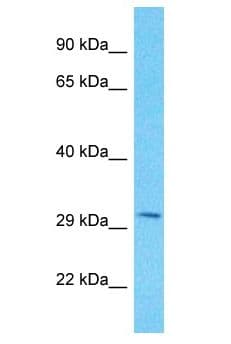 PPTC7 Antibody (aa162-211)