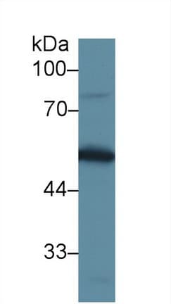 GC / Vitamin D-Binding Protein Antibody (aa395-473, PE)