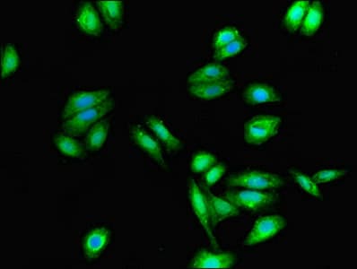 Polyclonal Rabbit anti-Human CYSLTR1 / CYSLT1 Antibody