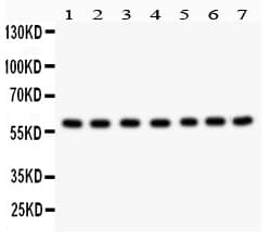 HSF2 Antibody (aa82-102)