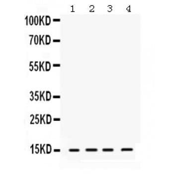 RBX1 / ROC1 Antibody (aa76-108)