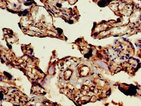 Polyclonal Rabbit anti-Human CENTD2 / ARAP1 Antibody (IHC, IF)