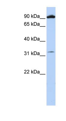GRM6 / MGLUR6 Antibody (aa36-85)