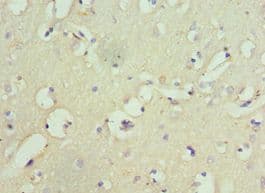 Polyclonal Rabbit anti-Human GRIA1 / GLUR1 Antibody (aa19-300, IHC)