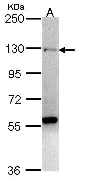 Polyclonal Rabbit anti-Human ZNF574 Antibody (aa162-358, WB)