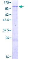 Human TRIM1 / MID2 Protein (Recombinant GST)