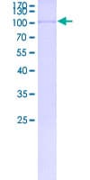 Human CCDC36 Protein (Recombinant GST)