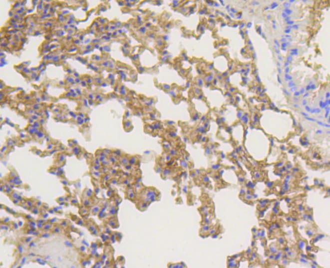 ARRB1 / Beta Arrestin 1 Antibody