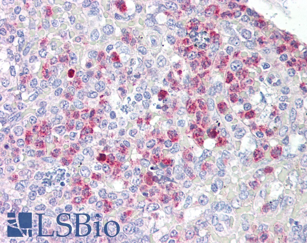 IHC-plus™ Polyclonal Rabbit anti-Human EIF2AK2 / PKR Antibody (aa418-467, IHC)
