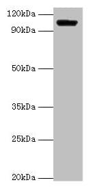 IHC-plus™ HK1 / Hexokinase 1 Antibody (aa13-475)