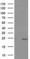 Monoclonal Mouse anti-Human SOCS3 Antibody (clone OTI6C12, IF, WB)