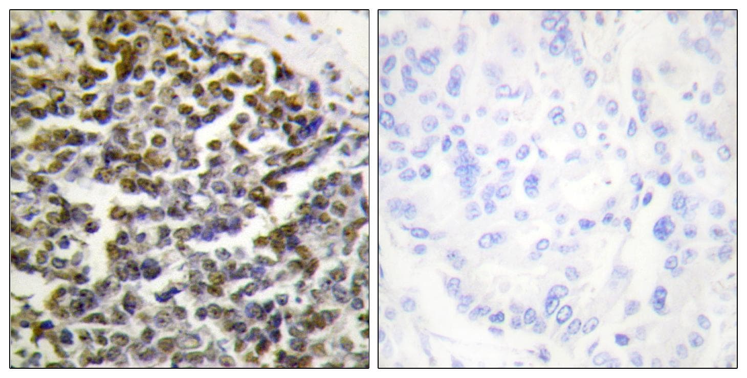 Treacle / TCOF1 Antibody