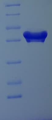 Human MOB1A Protein (Recombinant His-SUMO)