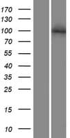 NFAT1 / NFATC2 Protein (Over-Expression Lysate Myc-DDK (Flag))