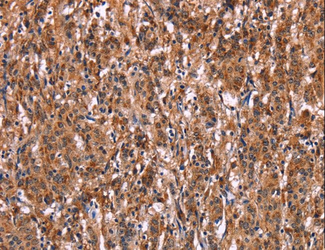 ILT2 / CD85 Antibody