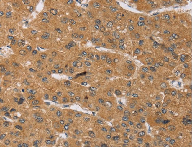 KCNJ15 / KIR4.2 Antibody