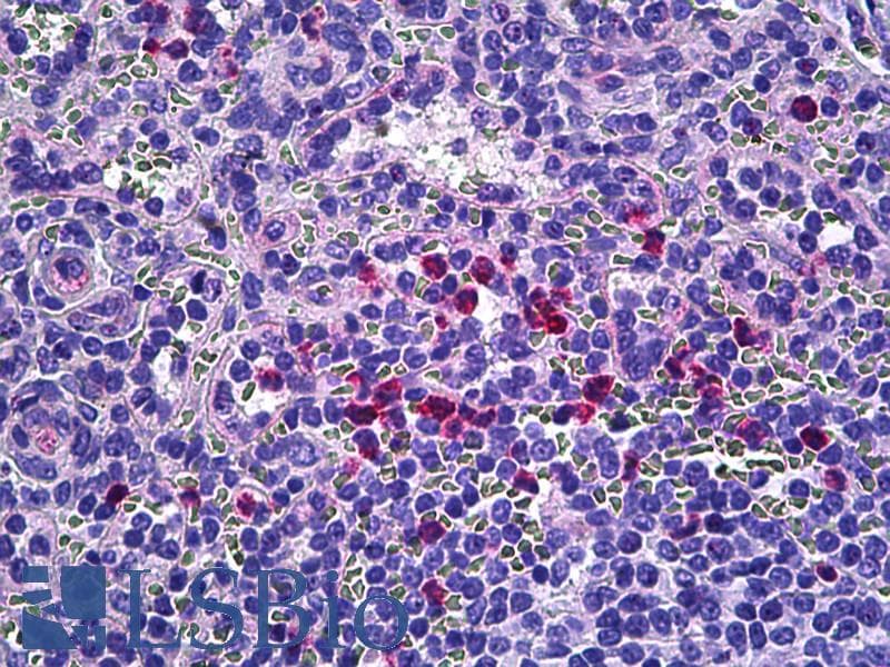 IHC-plus™ Polyclonal Rabbit anti-Human RBP5 Antibody (aa10-59, IHC, IF)