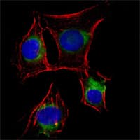 Monoclonal Mouse anti-Human NGFR / CD271 / TNR16 Antibody (clone 2F1C2, IF, WB)