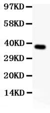 Polyclonal Rabbit anti-Human SYNCAM / CADM1 Antibody (aa45-340, WB)