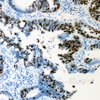 AML1 / RUNX1 Antibody (phospho-Ser276)
