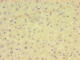 CPVL Antibody (aa23-476)