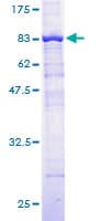 Human HERPUD1 / HERP Protein (Recombinant GST)