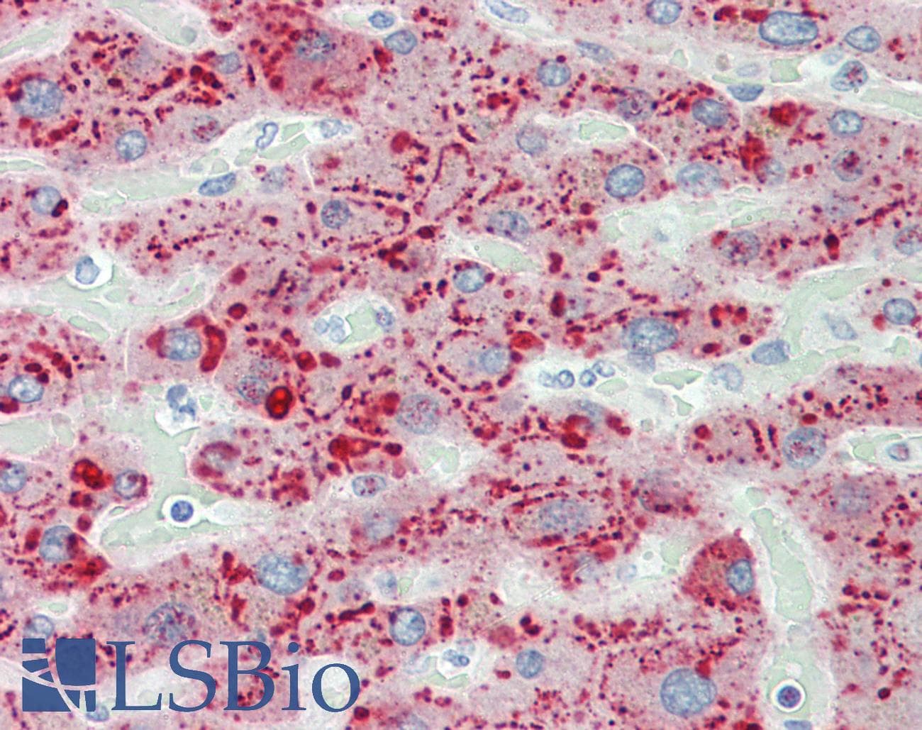 PathPlus™ Monoclonal Mouse anti-Human SAA1 / SAA / Serum Amyloid A Antibody (clone 5G6, IHC)
