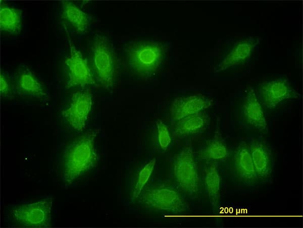 IHC-plus™ MKNK1 / MNK1 Antibody (clone 2H8)