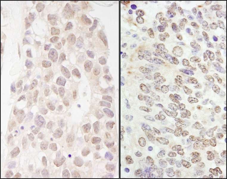GATAD2B Antibody (aa50-100)