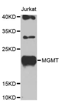 IHC-plus™ MGMT Antibody