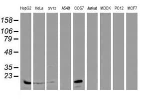 IHC-plus™ SAT2 Antibody (clone OTI2A3)